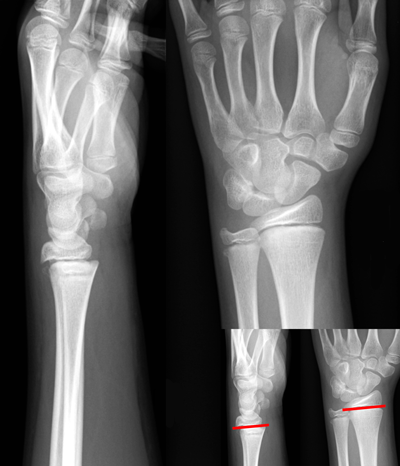 trip-injury-x-ray